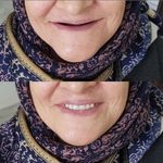 دندانسازی آرمیس(یلچی)