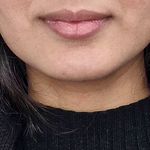 دکتر فخرالسادات نقیب شیراز فیلربادی و لب