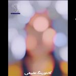 دکتر فخرالسادات نقیب شیراز فیلربادی و لب