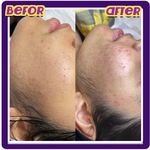 خدمات تخصصی پوست فیشال و کربوکسی فائزه