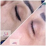 فیشال و پاکسازی پوست درنواب