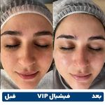 مرکز مژه و فیشیال متین