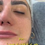 مرکز تخصصی فشیال صورت و اسکراب مو