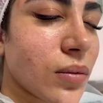 مرکز تخصصی فشیال صورت و اسکراب مو