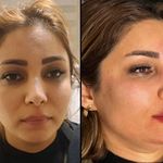 کلینیک زیبایی و مرکز لیزر ماهورا