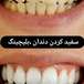 دندانپزشکی دکتر مجتبی نیکوزاده