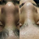 فیشال تخصصی محدثه رفیعی(محیرا)