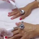 فیشال تخصصی و درمان جوش ولک Zhikan