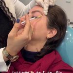 مرکز لیزر و کلینیک زیبایی پریفا