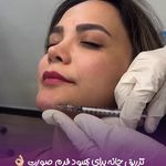 مرکز لیزر و کلینیک زیبایی پریفا