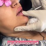 مرکز لیزر و کلینیک زیبایی پریفا