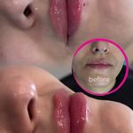 مرکز لیزر و کلینیک زیبایی پریفا