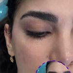 مرکز لیزر و کلینیک زیبایی پریفا