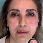 مرکز لیزر و کلینیک زیبایی پریفا