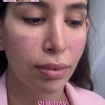 مرکز لیزر و کلینیک زیبایی پریفا