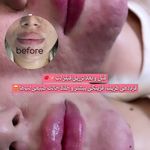 مرکز لیزر و کلینیک زیبایی پریفا