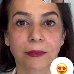 مرکز لیزر و کلینیک زیبایی پریفا