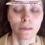 مرکز لیزر و کلینیک زیبایی پریفا