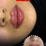 مرکز لیزر و کلینیک زیبایی پریفا