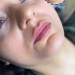 مرکز لیزر و کلینیک زیبایی پریفا