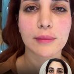 مرکز لیزر و کلینیک زیبایی پریفا