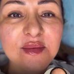 مرکز لیزر و کلینیک زیبایی پریفا