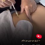 مرکز لیزر و کلینیک زیبایی پریفا