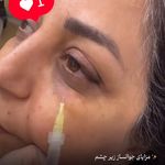 مرکز لیزر و کلینیک زیبایی پریفا