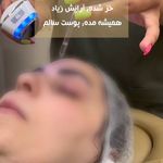 کلینیک زیبایی، پوست و لیزر(کندلا)  ظفر