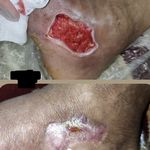 مهدی فتوحی درمان زخم پاکدشت ورامین قرچک