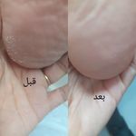 پدیکور و کف سابی