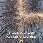 مرکز درمان شپش  آریافر