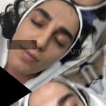 سالن تخصصی فیشیال نارسیس