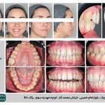 رادیولوژی و سونوگرافی بتا