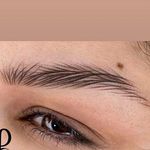 مطب پوست ،مو و لیزر یسنا طب