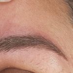 مطب پوست ،مو و لیزر یسنا طب