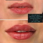 مطب پوست ،مو و لیزر یسنا طب