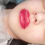 مطب پوست ،مو و لیزر یسنا طب