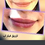 مطب پوست ،مو و لیزر یسنا طب