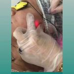 مطب پوست ،مو و لیزر یسنا طب