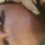 مطب پوست ،مو و لیزر یسنا طب