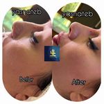 مطب پوست ،مو و لیزر یسنا طب