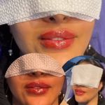 کلینیک تخصصی لیزر موهای زائد پریناز شرق