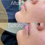 کلینیک زیبایی، پوست و لیزر(کندلا)  ظفر