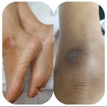 کفسابی و پدولوژی ناخن خانمها و آقایان