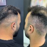 مرکز تخصصی میکرو اسکالپ