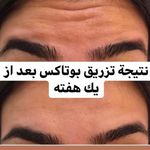 کلینیک زیبایی و مرکز لیزر نیوشا