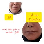 کلینیک زیبایی و مرکز لیزر نیوشا