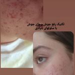 خدمات تخصصی ودرمانی با سلولهای بنیادی