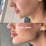 کلینیک پوست مو زیبایی فیلر بوتاکس نارسا